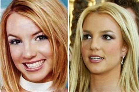 britney spears original nose|Understanding Britneys Nose Job Debunking Myths and